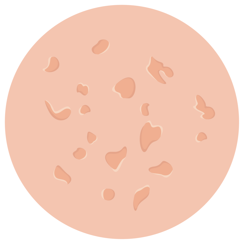 Atrophe Narben Icon