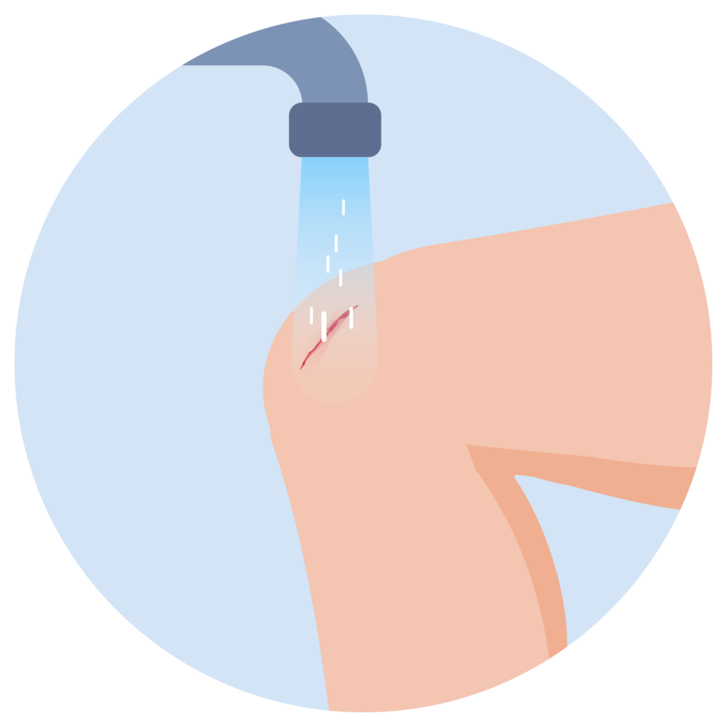 Knie wird unter fließendem Wasser gereinigt, um Verunreinigungen und Blut zu entfernen.