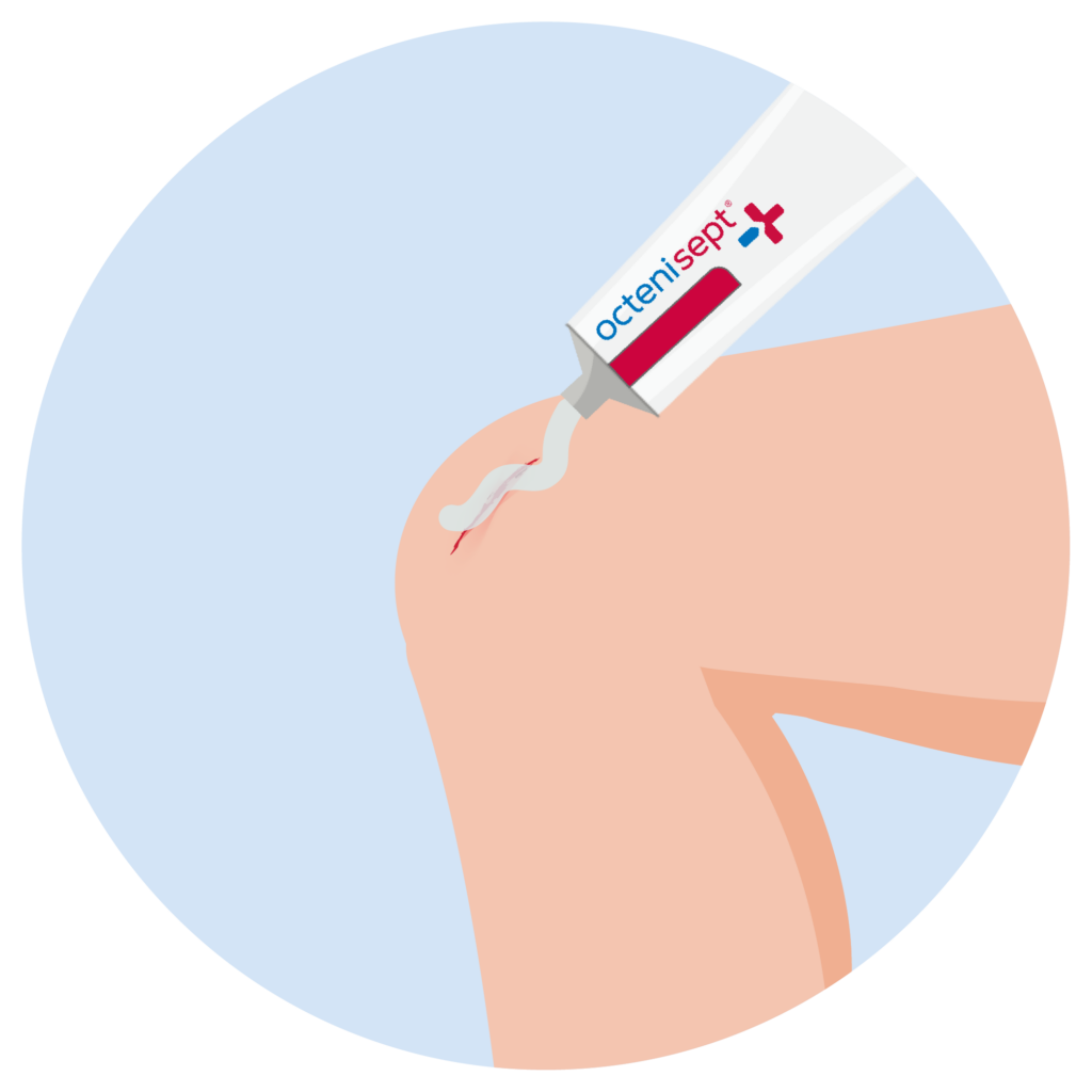 octenisept® Gel wird auf eine Wunde am Knie aufgetragen, um den Wundverschluss zu fördern und vor Keimen zu schützen.